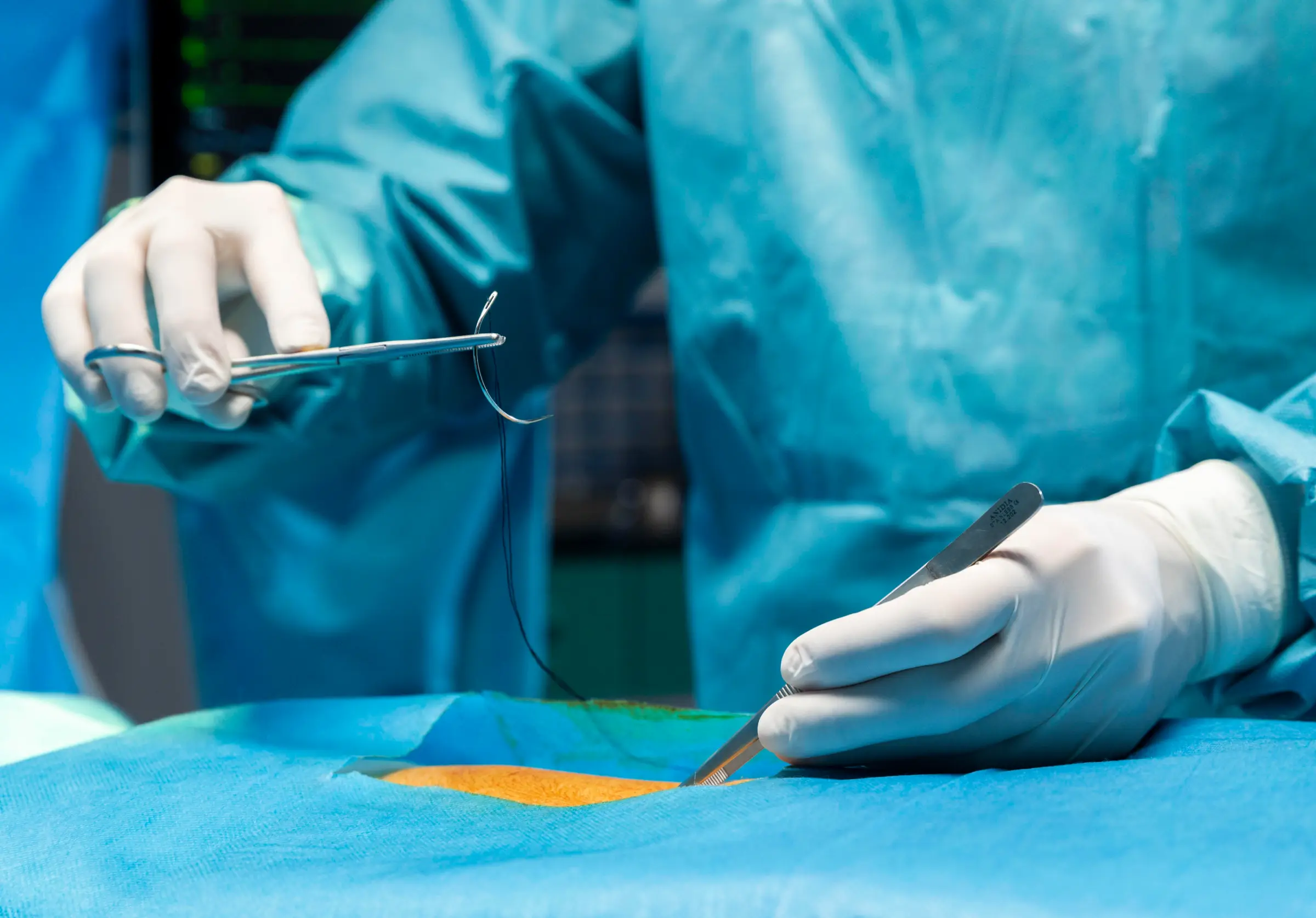 Gloved surgeon holding a scalpel
