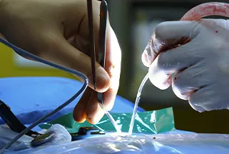 Precision instruments used during surgery